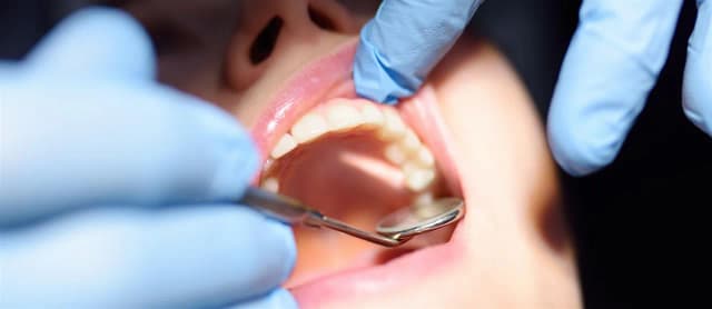 Najczęstsze problemy periodontologiczne i jak je rozpoznać Najczęstsze problemy periodontologiczne i jak je rozpoznać