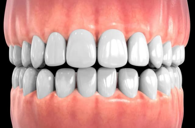 Skuteczne metody na stan zapalny dziąseł - jak uniknąć bólu i problemów Skuteczne metody na stan zapalny dziąseł - jak uniknąć bólu i problemów