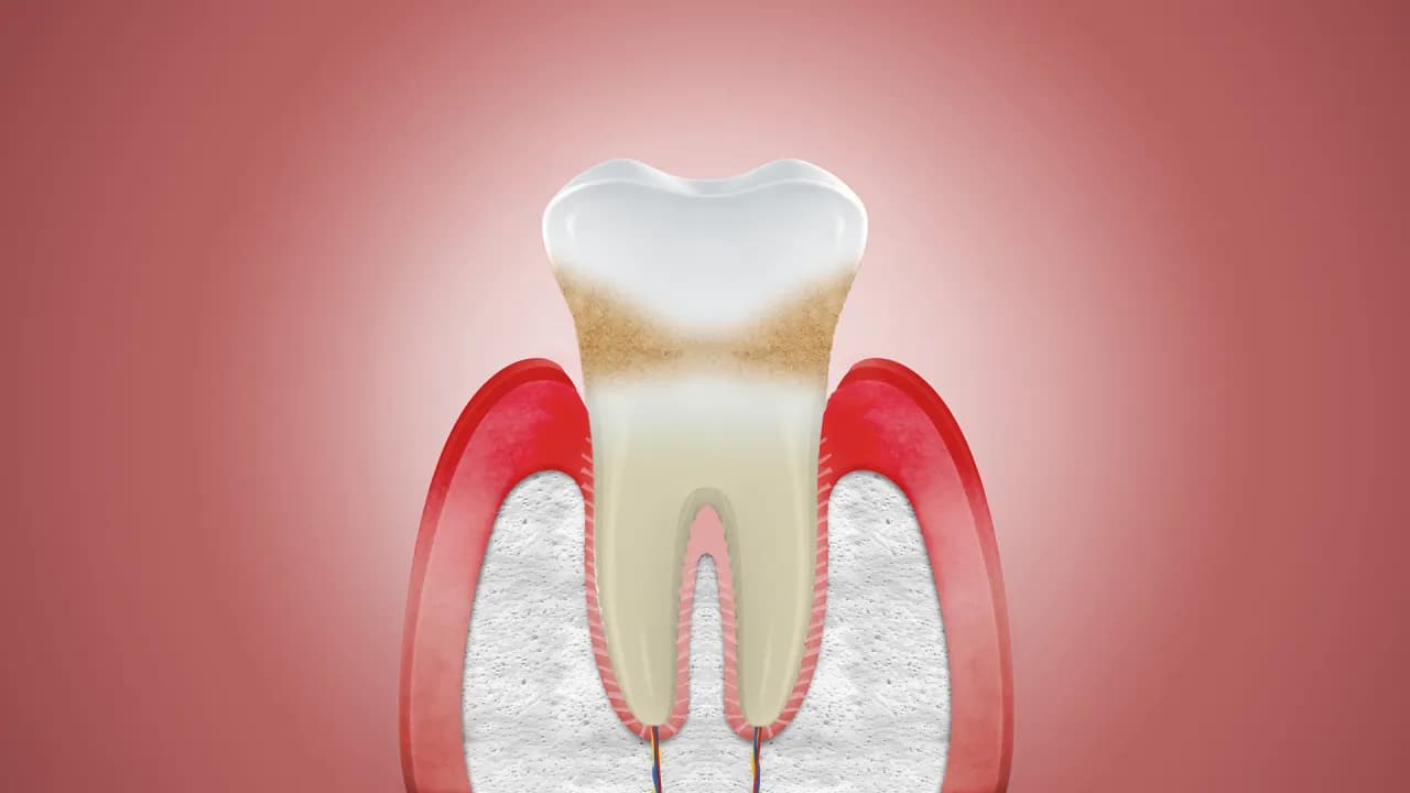 Czy dziąsła się regenerują? Odkryj prawdę o ich zdrowiu Czy dziąsła się regenerują? Odkryj prawdę o ich zdrowiu