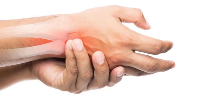 Jakie leki na zerwane ścięgna? Skuteczne metody łagodzenia bólu Jakie leki na zerwane ścięgna? Skuteczne metody łagodzenia bólu