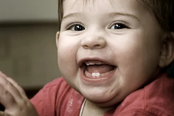 Górne jedynki ząbkowanie: jak wyglądają dziąsła i co oznaczają? Górne jedynki ząbkowanie: jak wyglądają dziąsła i co oznaczają?