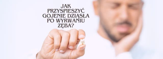 Jak przyspieszyć gojenie dziąsła po wyrwaniu zęba i uniknąć bólu Jak przyspieszyć gojenie dziąsła po wyrwaniu zęba i uniknąć bólu