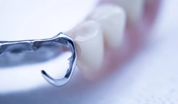 Jak usunąć klej do protez z dziąseł? Skuteczne metody bez bólu Jak usunąć klej do protez z dziąseł? Skuteczne metody bez bólu