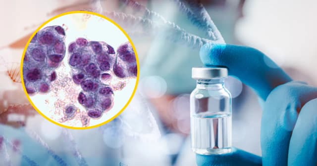 Czy jest skuteczny lek na raka? Odkryj prawdę o terapiach i nadziei Czy jest skuteczny lek na raka? Odkryj prawdę o terapiach i nadziei